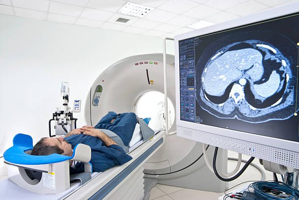 keterbatasan pet scan